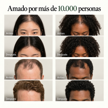 Naori™ — Barra Coreana para Revitalizar el Cuero Cabelludo y Fortalecer el Cabello